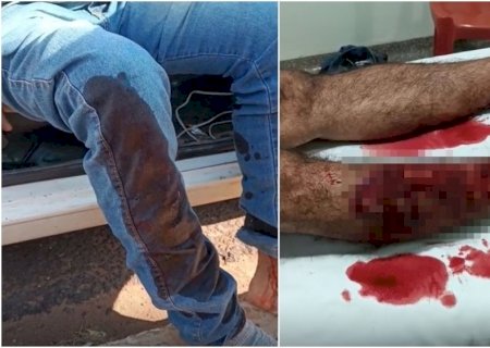Idoso é atacado por dois cães e hospitalizado em Nova Andradina