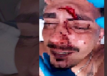 Jovem é atingido por garrafada na cabeça durante a Fejuna e acaba hospitalizado em Nova Andradina